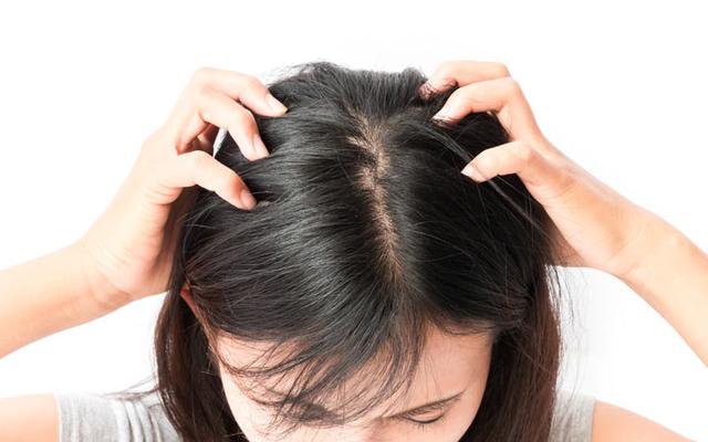 How to Get Rid of Head Lice the First Time?